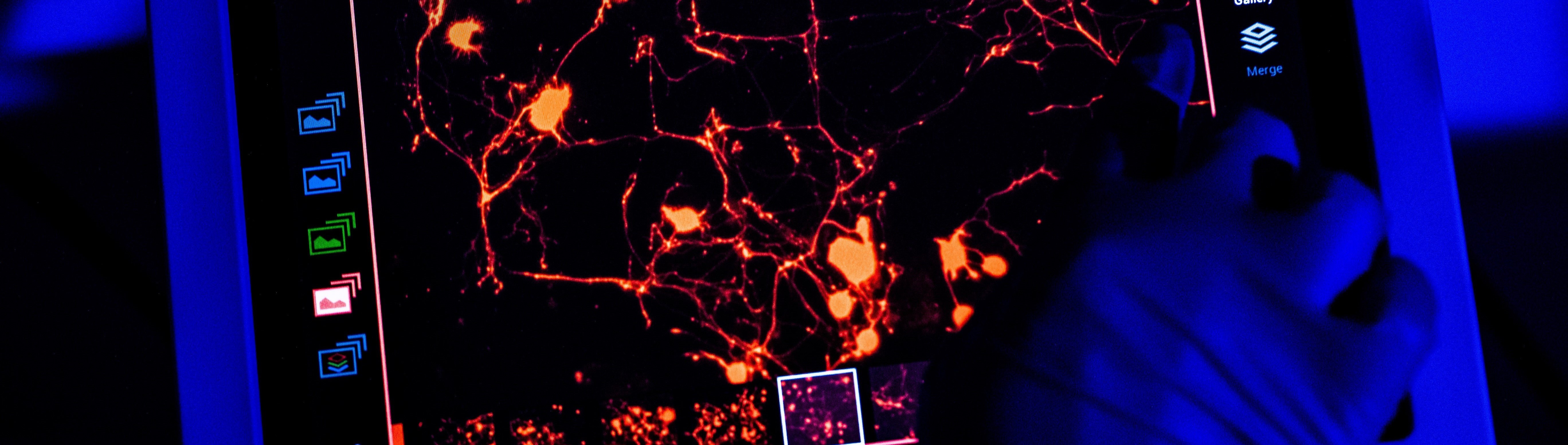 Neural Networks Neural Networks